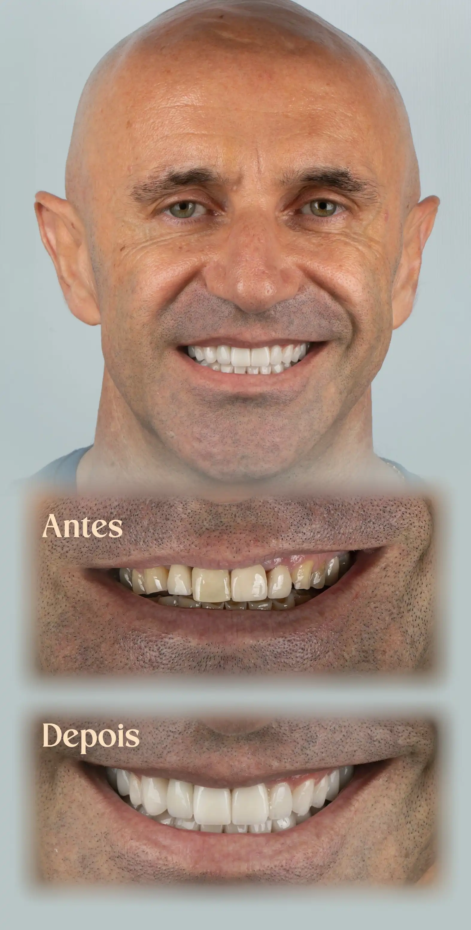 Resultado do Procedimento