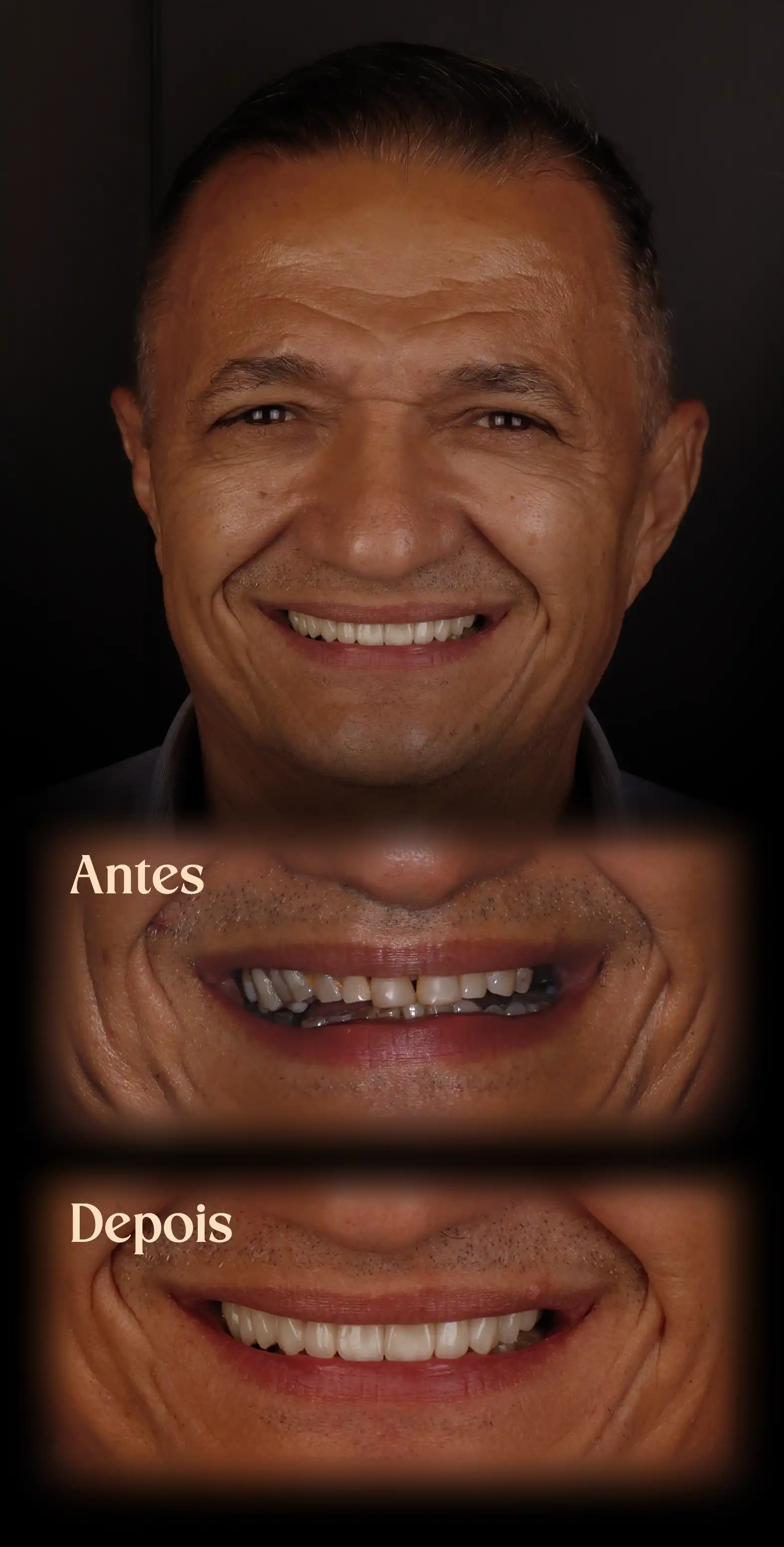 Resultado do Procedimento