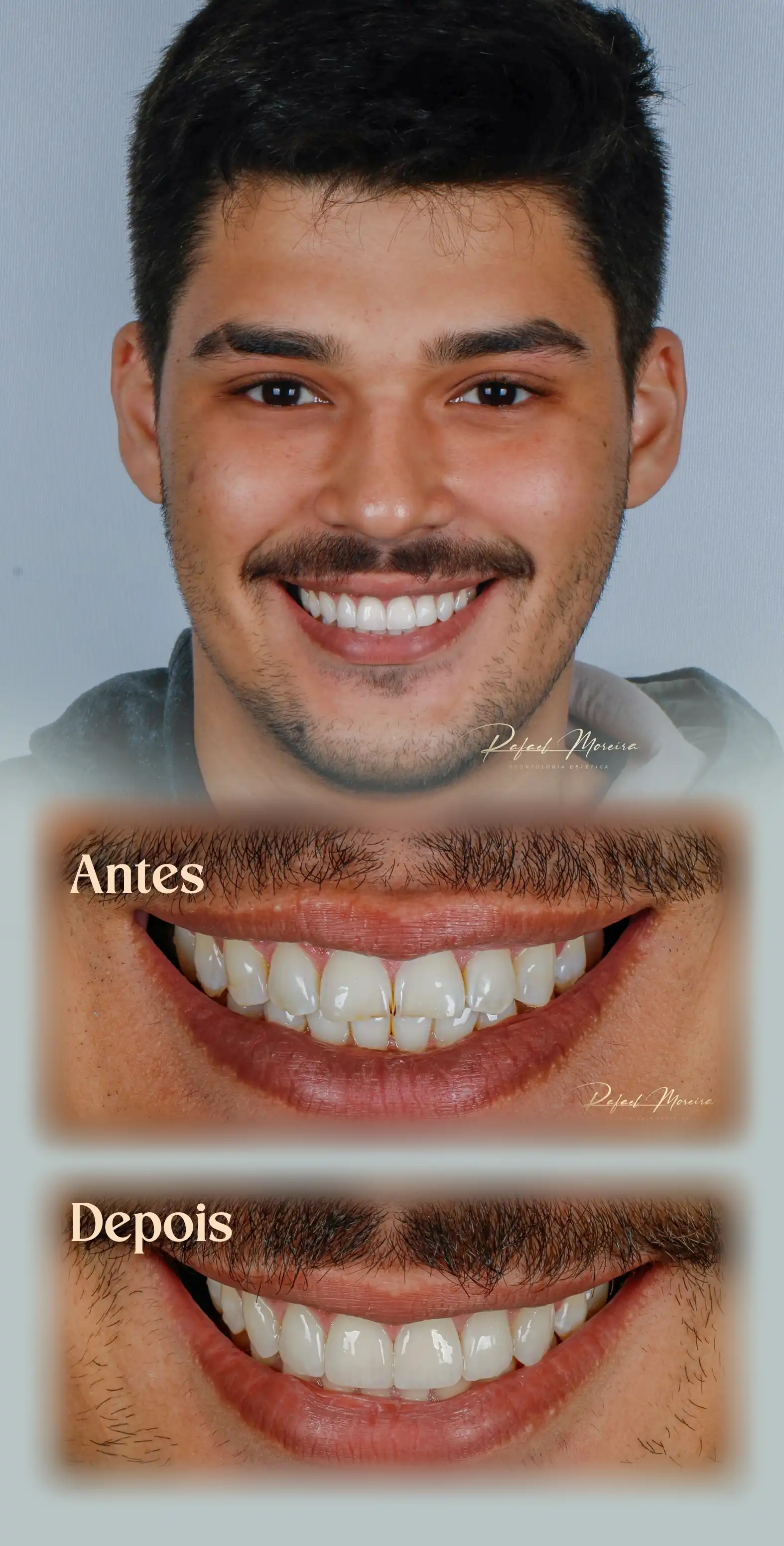 Resultado do Procedimento