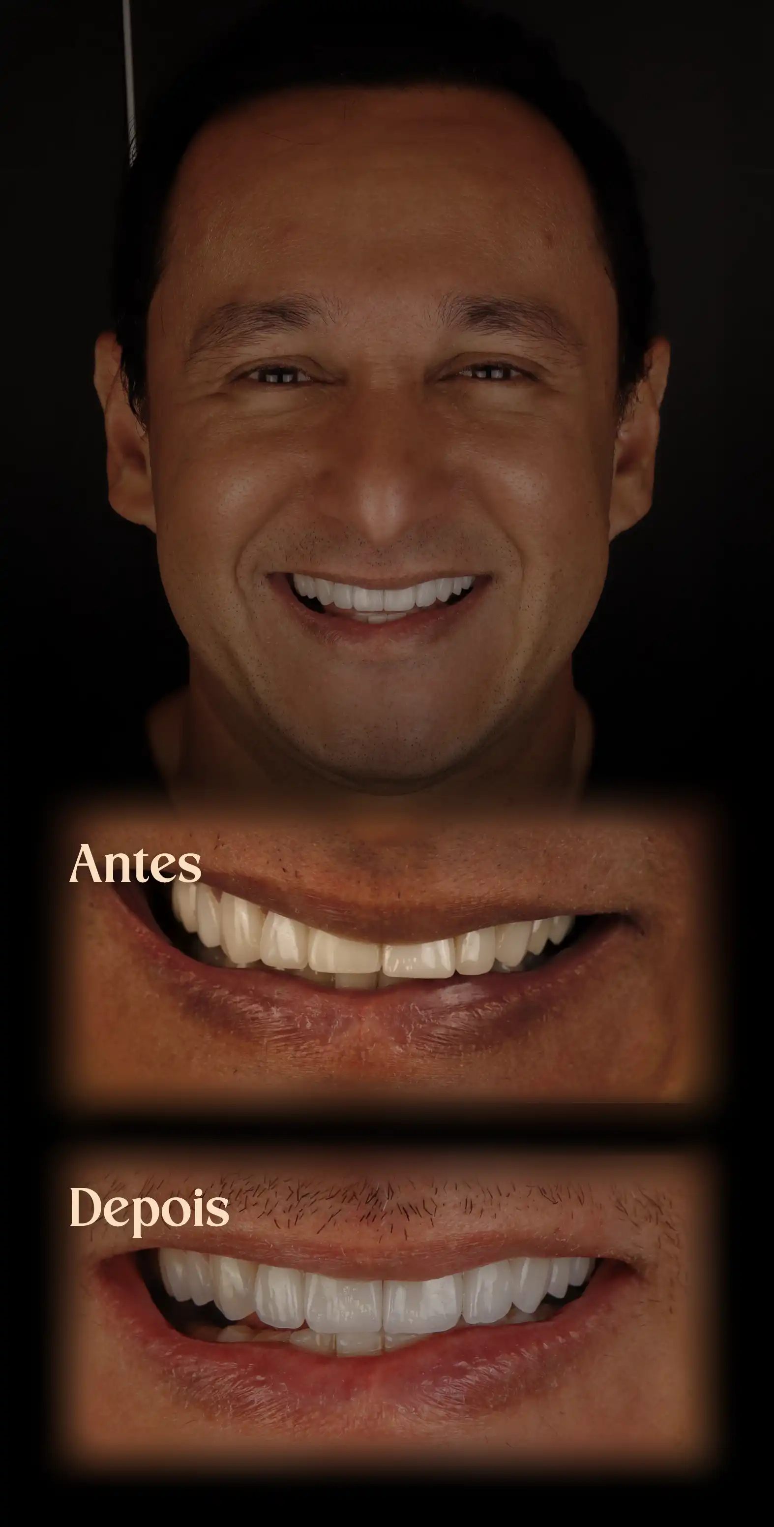 Resultado do Procedimento