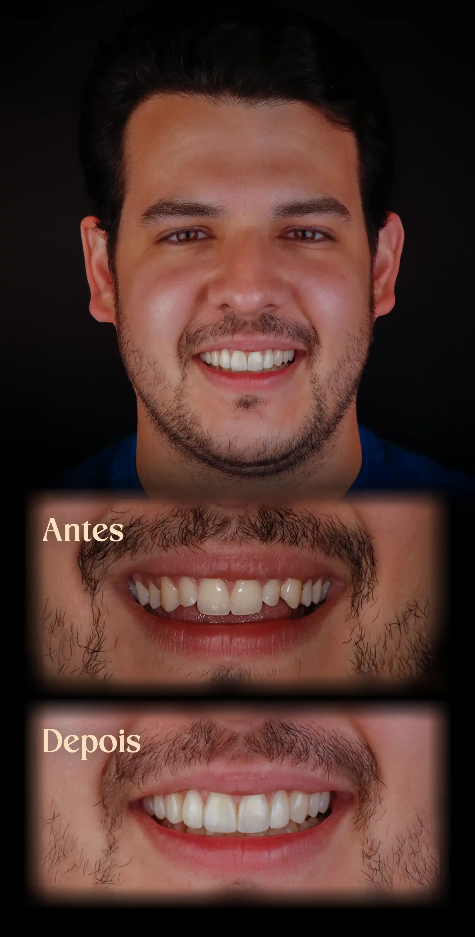 Resultado do Procedimento
